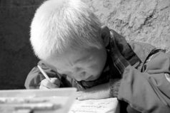 為什么少年長白發(fā)？由色素細(xì)胞衰退導(dǎo)致